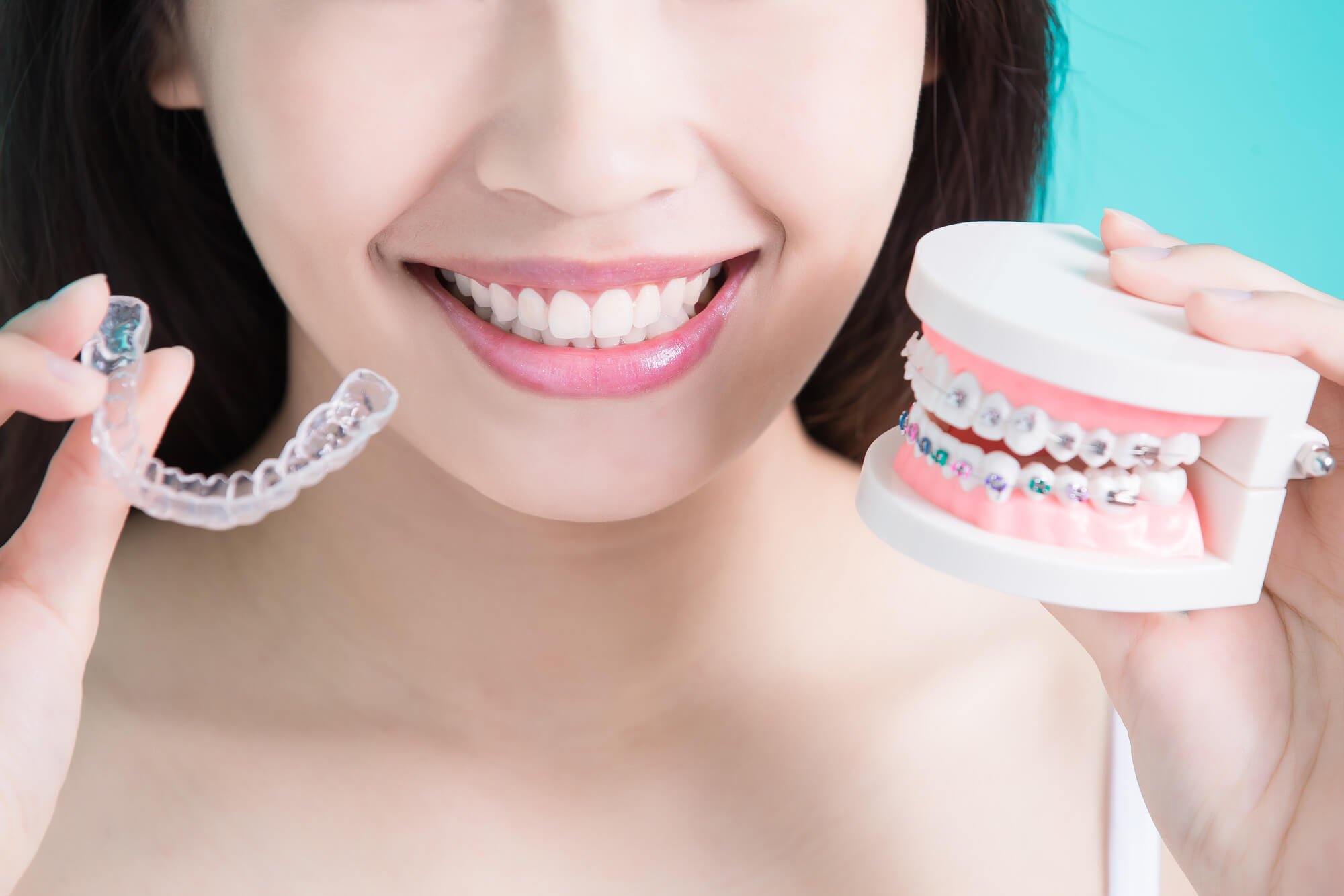 wl-invisalign (2)