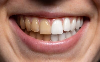 Hazards hiding in your mouth
