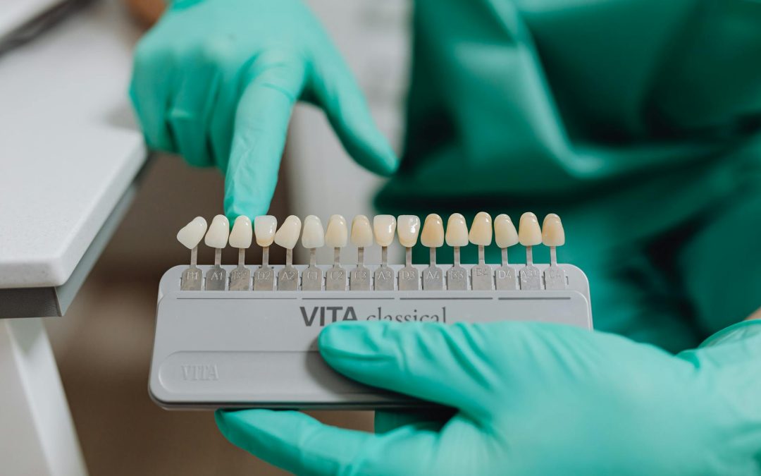 Dental Veneers: The Ultimate Guide to a Perfect Smile in the UK