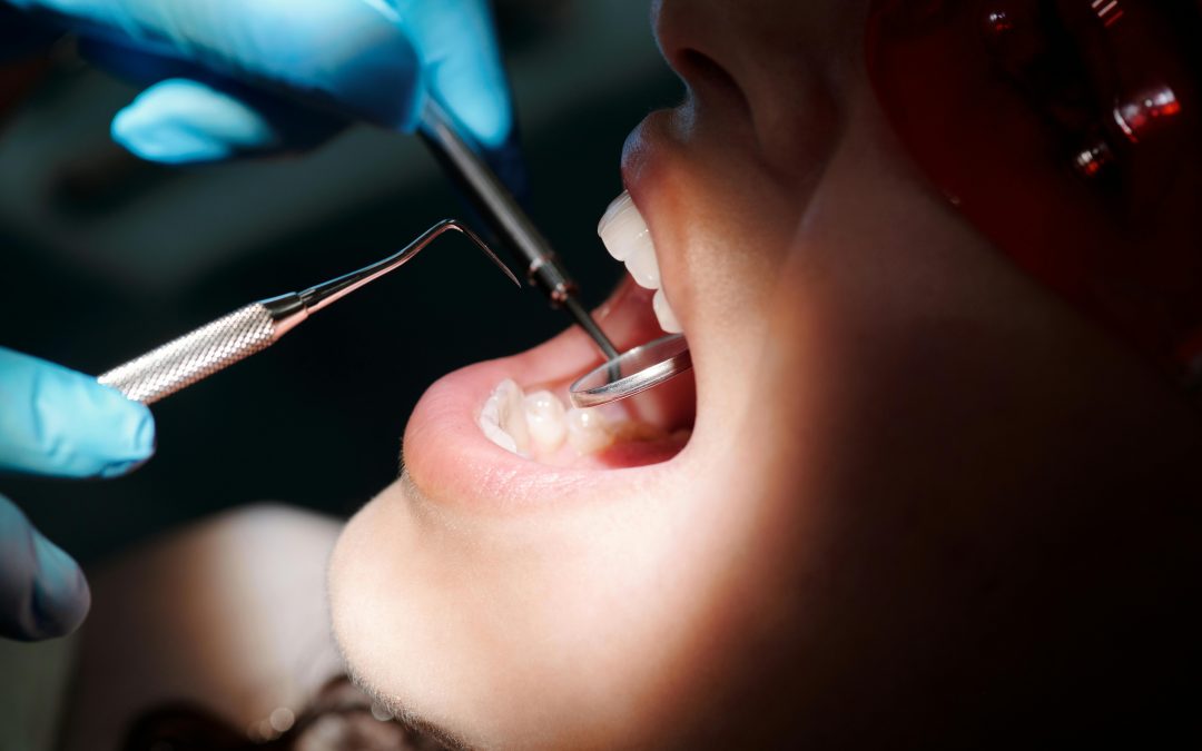 Say Goodbye to Dental Anxiety: How Sedation Dentistry Can Help You Relax