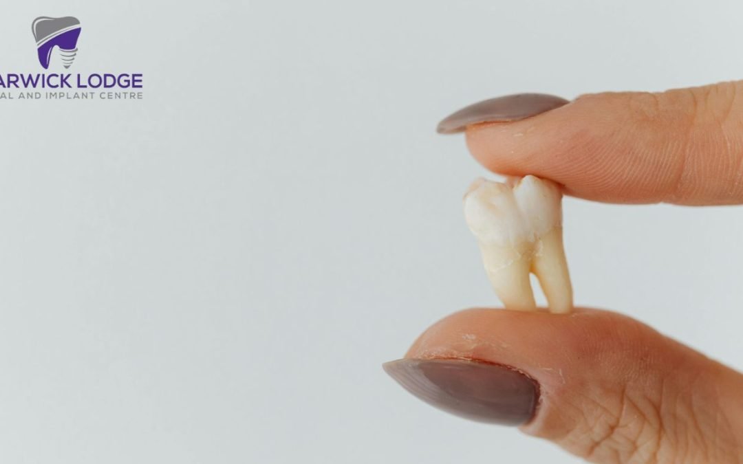 Surgical Tooth Extractions: A Complete Guide Before and After Care
