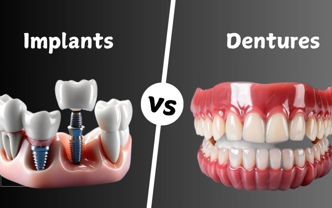 Dental Implants vs. Dentures: Which Tooth Replacement Option is Right for You?